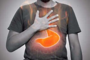 foto de uma pessoa com a mão no peito e uma imagem de um estômago vermelho na região da barriga para representar a queimação no estôamgo