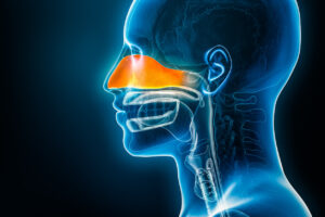 imagem de raio-x 3d de uma cabeça mostrando a regiaõ interna dos narizes em vermelho, indicando a sinusite.